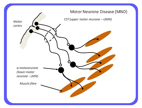 New research helps fight against motor neurone disease