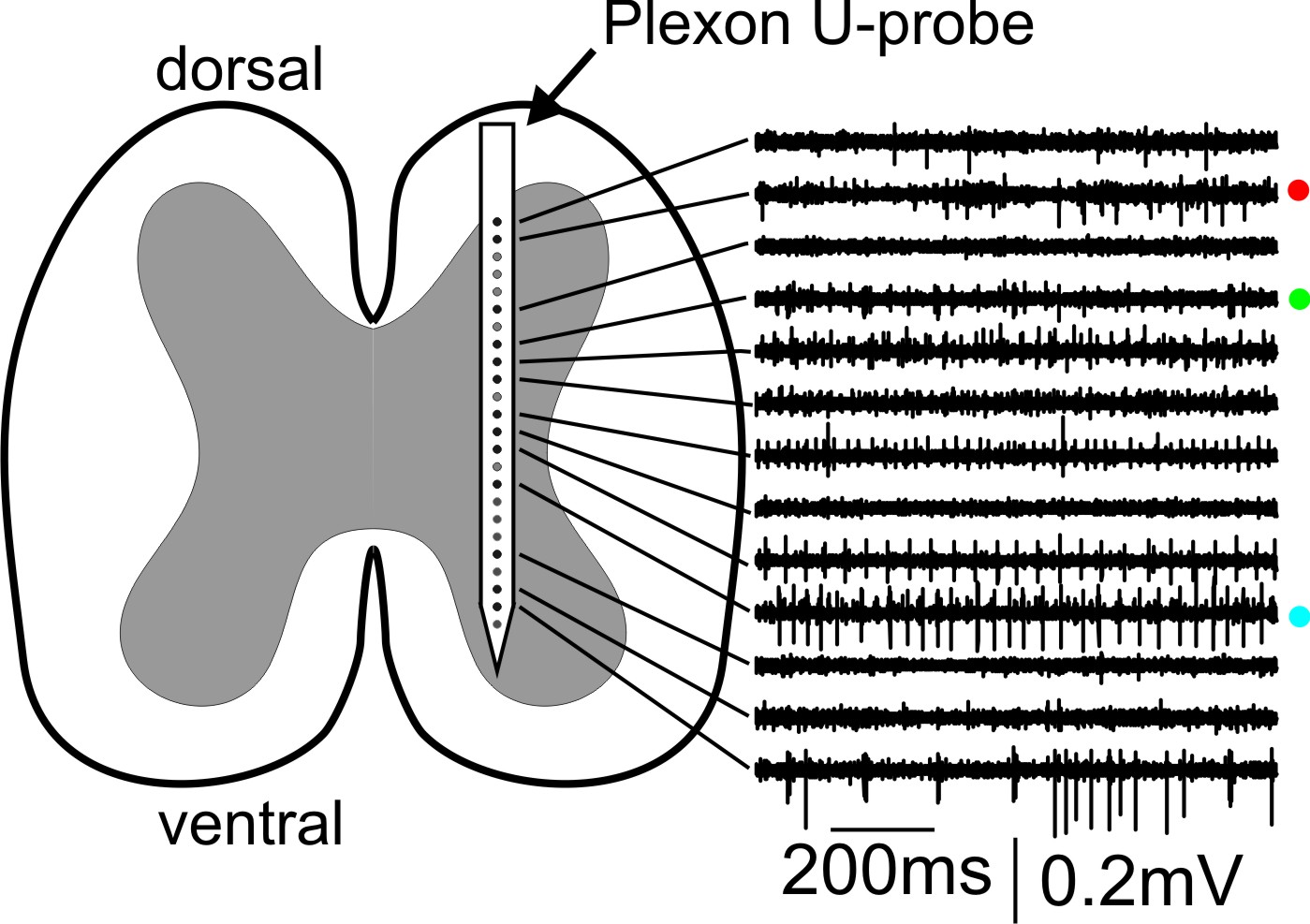 Plexon